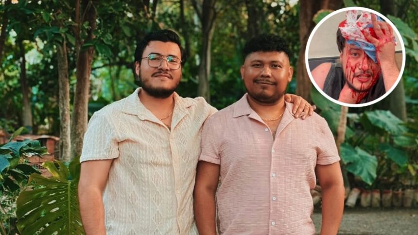 Crimen de odio en Puebla Fabian agredido a punaladas durante