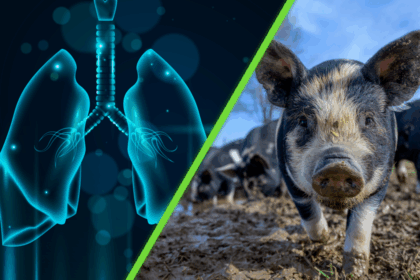 Científicos realizan trasplante de pulmón de cerdo modificado genéticamente en ser humano