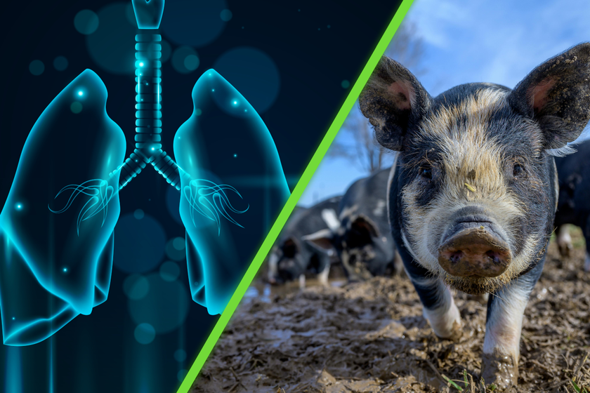 Científicos realizan trasplante de pulmón de cerdo modificado genéticamente en ser humano