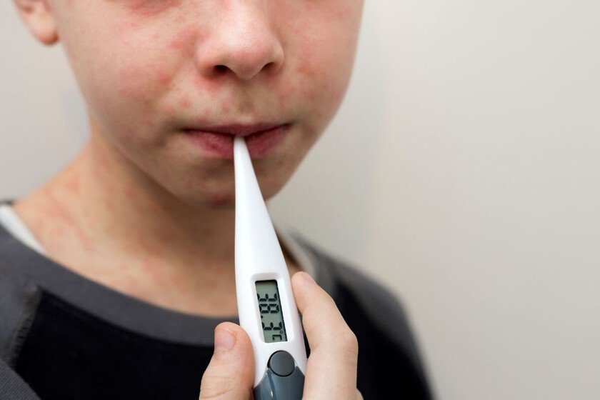 México registra el mayor número de muertes por sarampión en América, todas sin vacunar