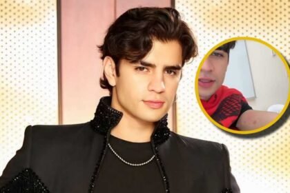 Aarón Mercury presenta moretones y golpes tras coreografía en Las Estrellas Bailan en Hoy