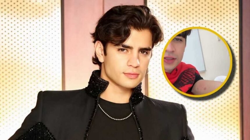 Aarón Mercury presenta moretones y golpes tras coreografía en Las Estrellas Bailan en Hoy