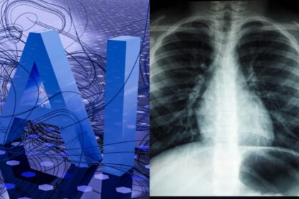 la deteccion oportuna con inteligencia artificial disminuye la mortalidad por