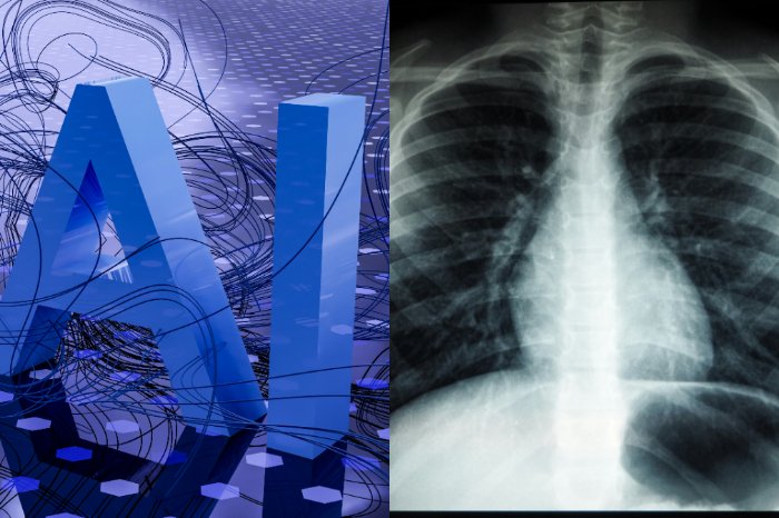 la deteccion oportuna con inteligencia artificial disminuye la mortalidad por