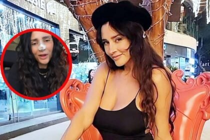 Dorismar revela su nuevo rostro tras cirugía facial