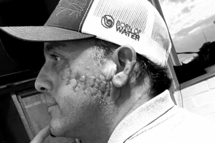 hombre sobrevive a mordida y continua su defensa de los