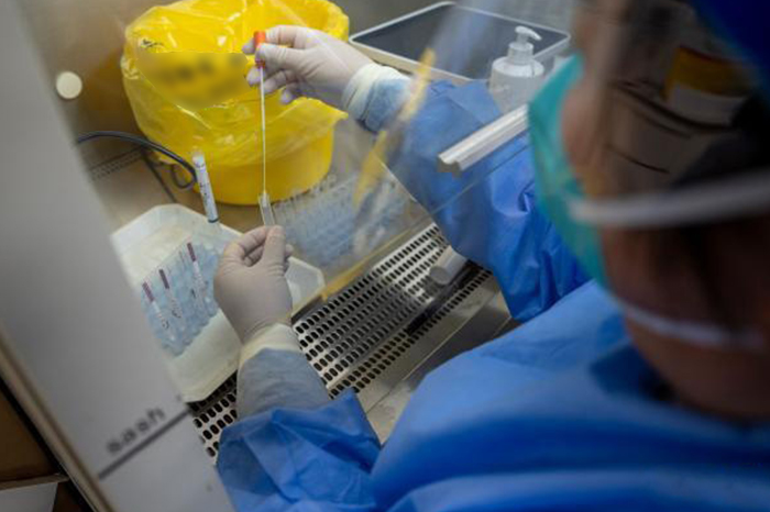 ssa reporta primer caso de la variante k de influenza