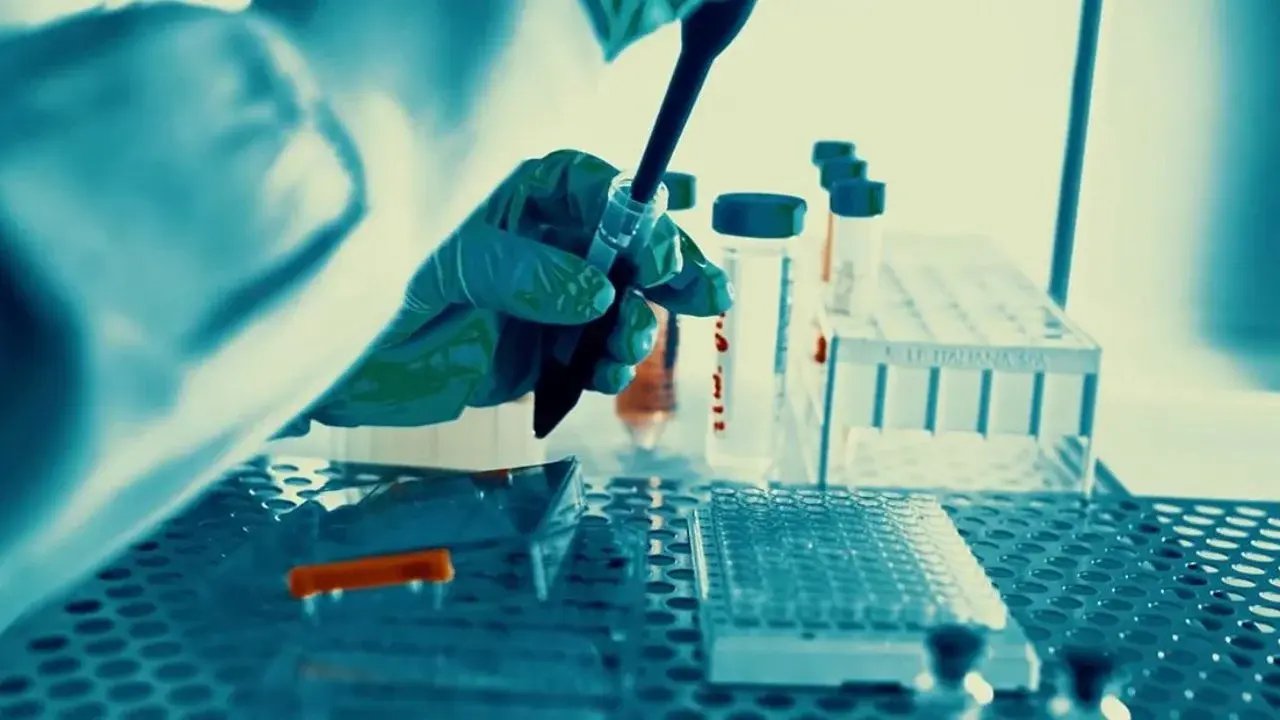 Ciudad de México: contagios de VIH suben 50% y escasean medicamentos
