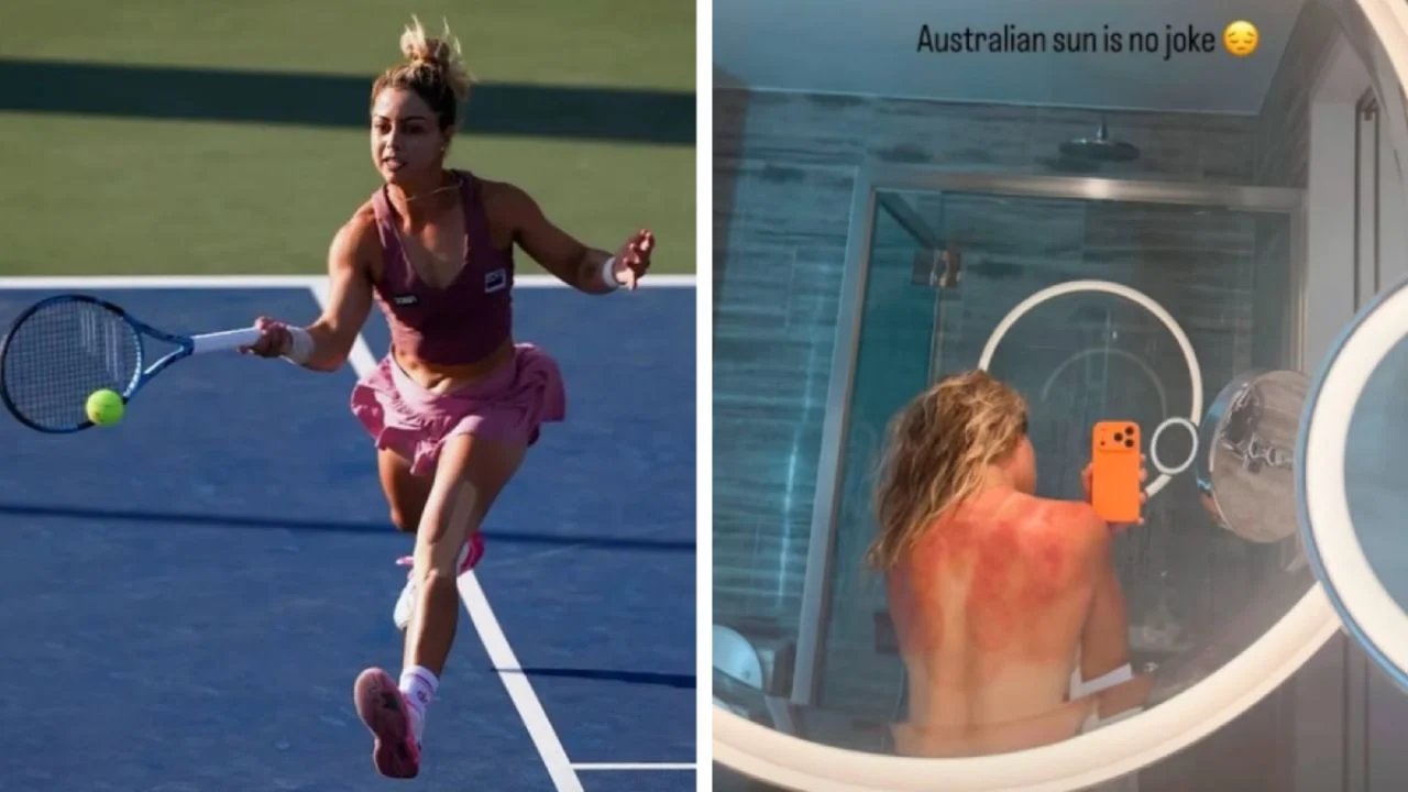 Renata Zarazúa muestra marcas de sol en Hobart