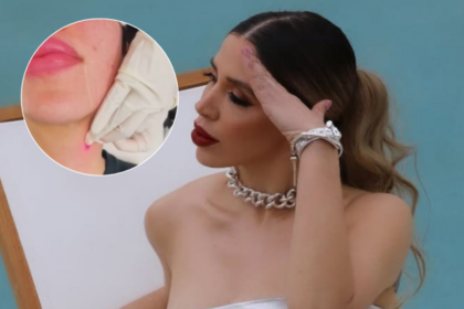 Emma Coronel muestra su tratamiento para reducir la papada