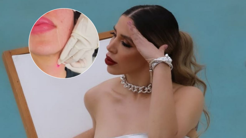 Emma Coronel muestra su tratamiento para reducir la papada