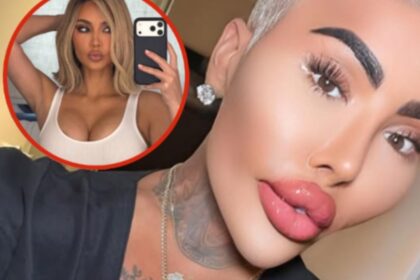 Fallece el influencer Jordan James Parke tras cirugía estética