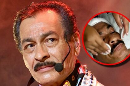 Eduardo Hernández de Los Tigres del Norte muestra resultado de facial