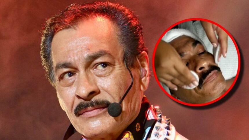 Eduardo Hernández de Los Tigres del Norte muestra resultado de facial