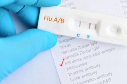 Primer caso humano de gripe aviar AH9N2 confirmado en Italia