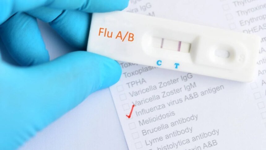 Primer caso humano de gripe aviar AH9N2 confirmado en Italia