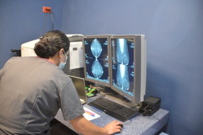 SSG refuerza baciloscopías para detectar tuberculosis en Guerrero