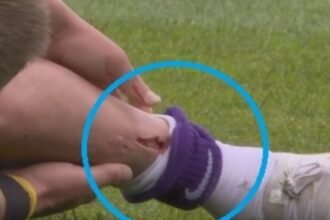 Futbolista en la Eredivisie sufre corte; cuestionan uso de espinilleras cortas