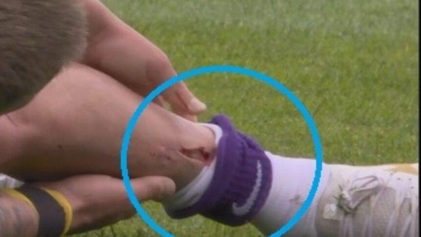 Futbolista en la Eredivisie sufre corte; cuestionan uso de espinilleras cortas