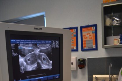 SSG supera 8,000 citas de especialidad en Hospital General de León, Guanajuato