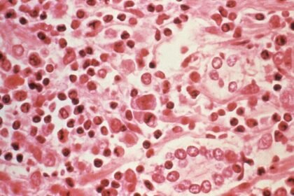 Evacuación de pacientes con hantavirus en crucero de Países Bajos