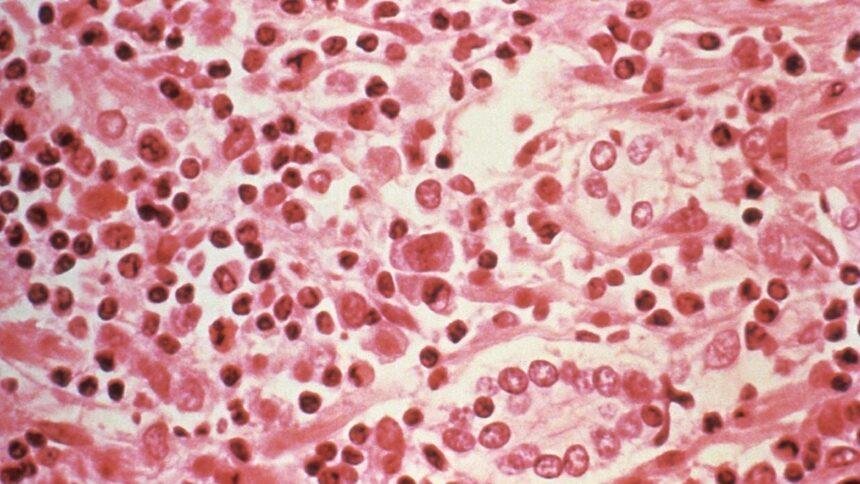Evacuación de pacientes con hantavirus en crucero de Países Bajos