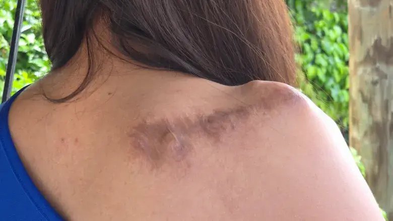 Madre de Ángel Yael exige responsabilidad al Gobierno tras fallo judicial