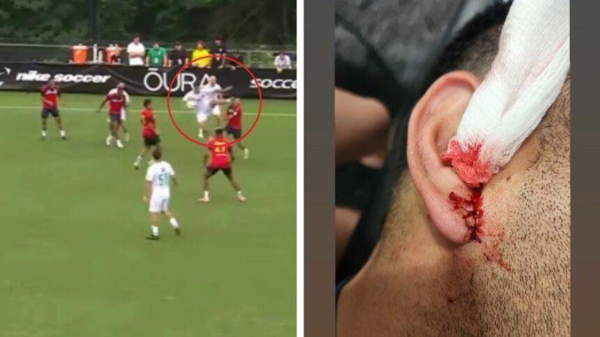 Marco Fabián sufre fuerte patada que le causa cuatro puntos de sutura
