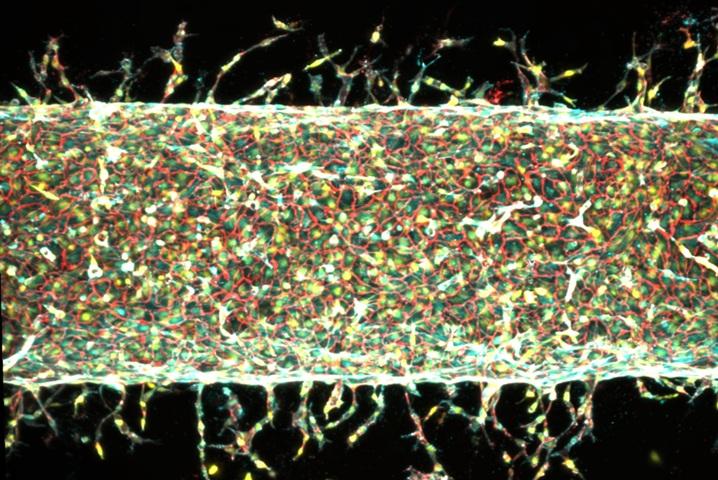 Fabricación de vasos sanguíneos: nuevo método investigado por el MIT