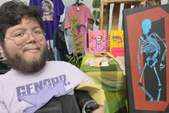 artista leones transforma la discapacidad y la espera medica en Artista leonés transforma la discapacidad y la espera médica en expresión artística