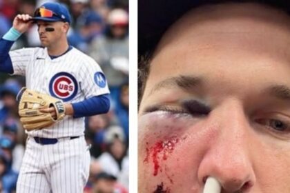 alex bregman de cachorros sufre pelotazo en la cara por Alex Bregman, de Cachorros, sufre pelotazo en la cara por distraído