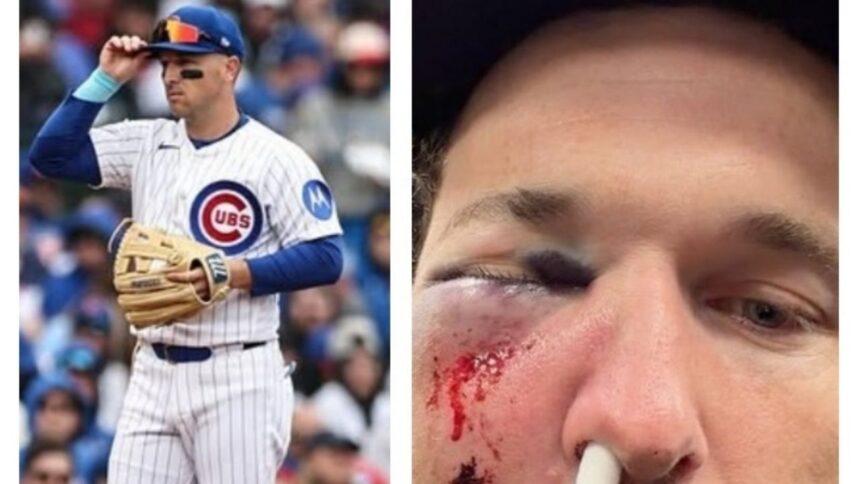 Alex Bregman, de Cachorros, sufre pelotazo en la cara por distraído