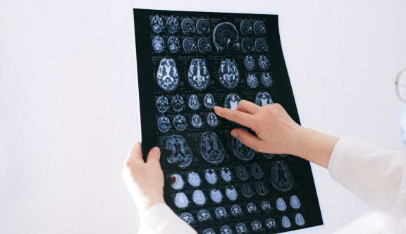 Cómo cambia el cerebro después de medianoche y afecta al sueño